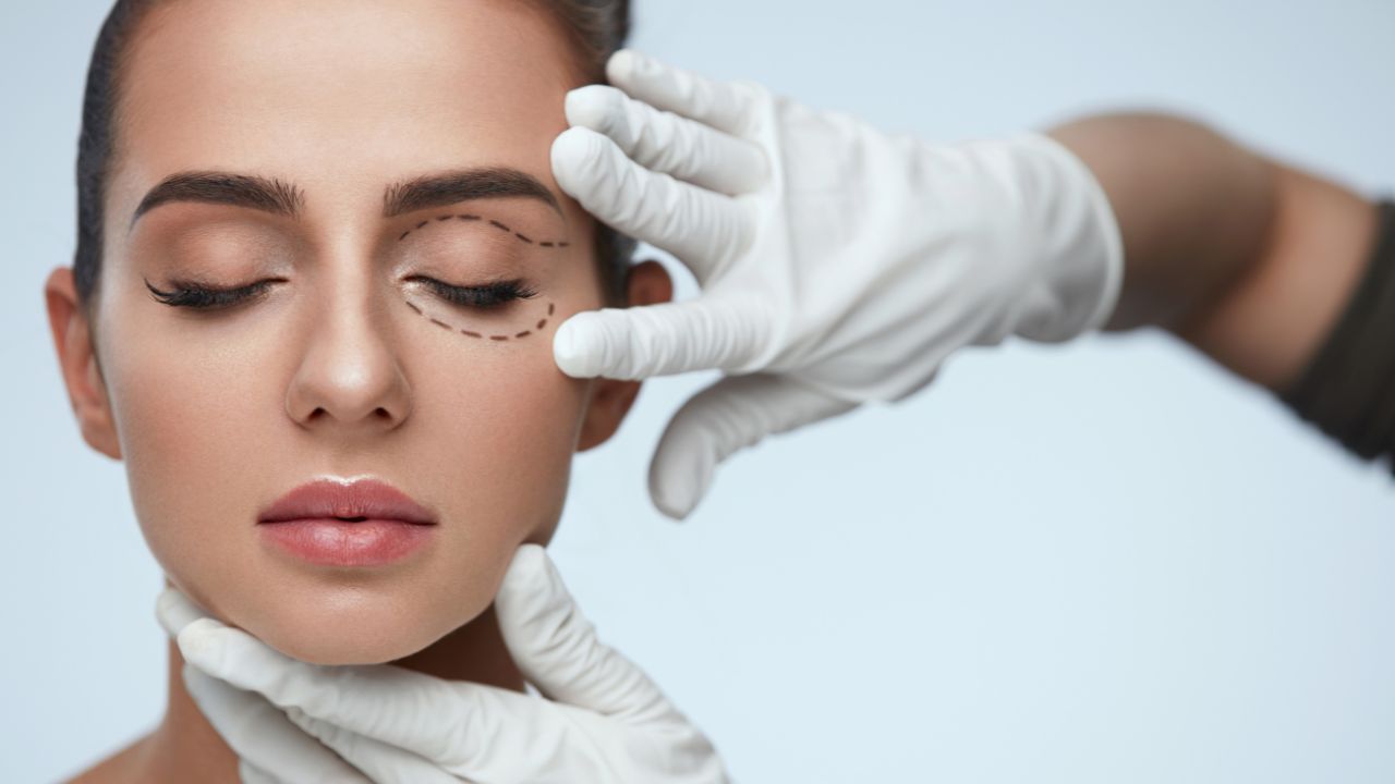 Blefaroplastia é um dos procedimentos mais populares no Brasil